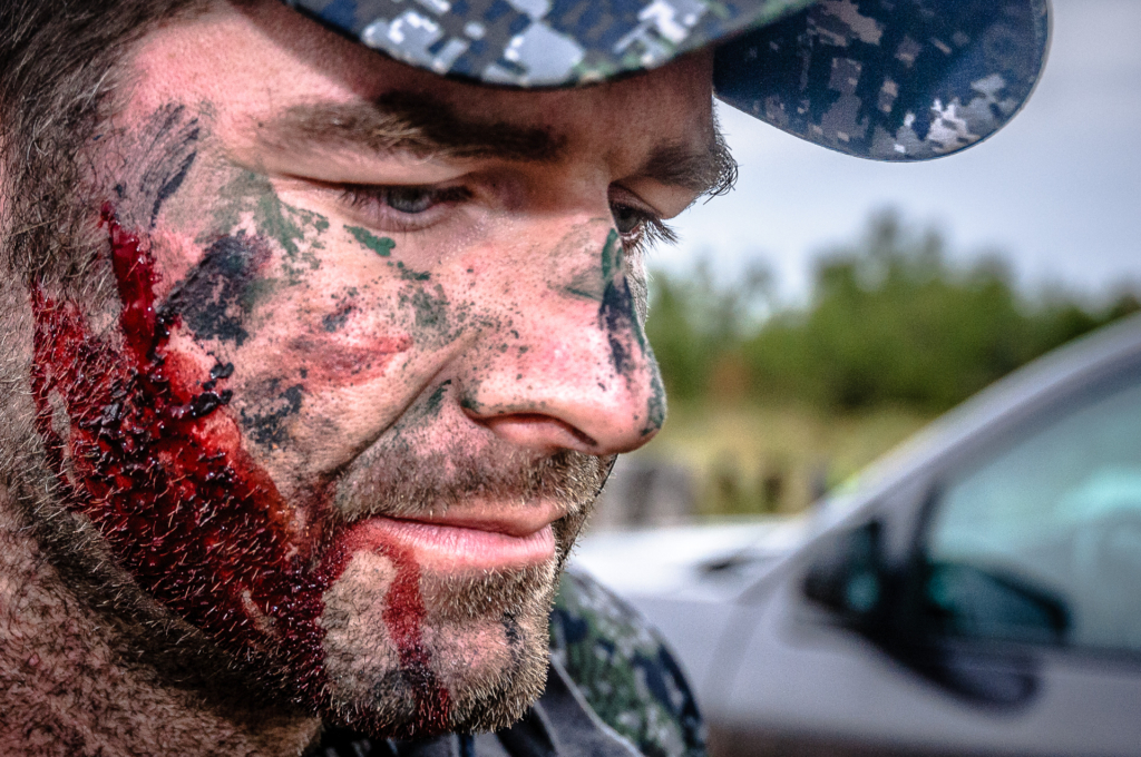 My Top 4 Hunting Injuries & How I Dealt With Them