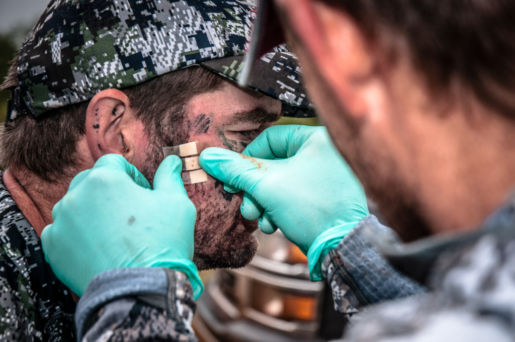 My Top 4 Hunting Injuries & How I Dealt With Them