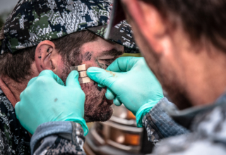 My Top 4 Hunting Injuries & How I Dealt With Them