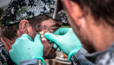 My Top 4 Hunting Injuries & How I Dealt With Them